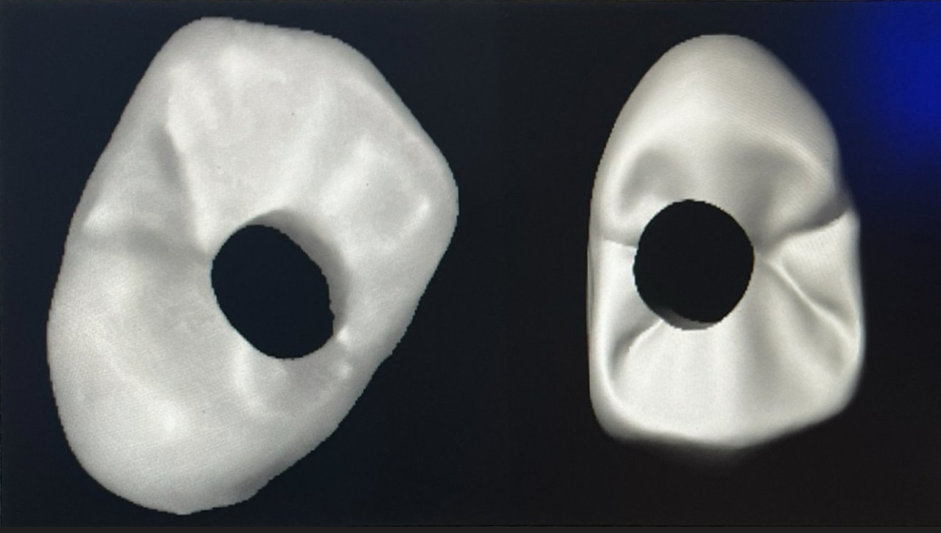 Dental Crown Inspection System